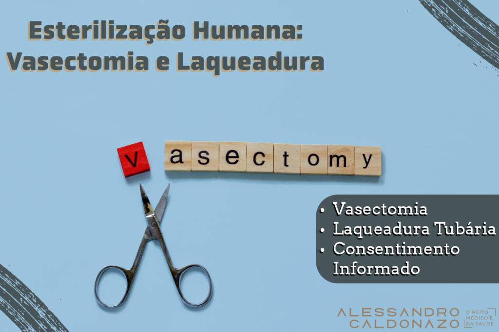 Esterilização Humana: Vasectomia e Laqueadura Tubária - Médico - Paciente - Consentimento Informado - Dr. Alessandro Caldonazo, Advogado especialista em Direito Médico e da Saúde, Campinas, SP